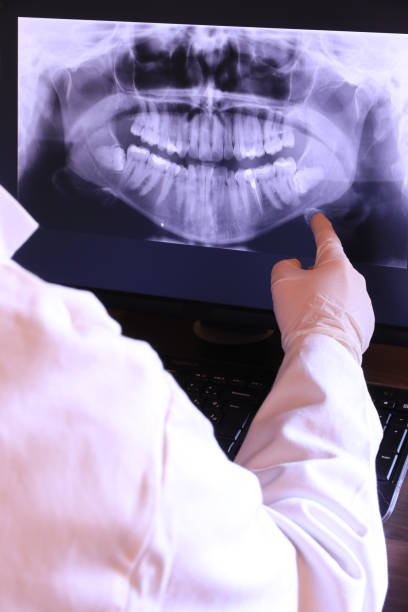 Best Broken or Chipped Tooth Repair in Cupertino, CA