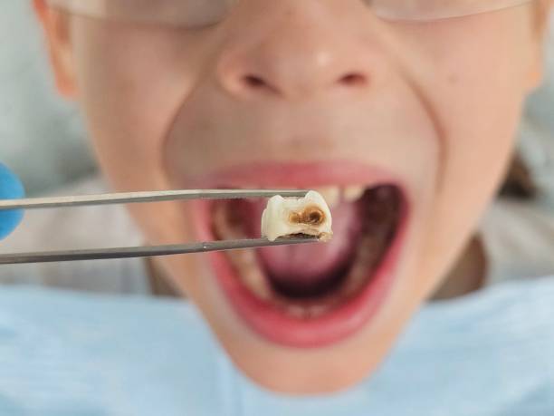 Best Walk-In Emergency Dental Services in Cupertino, CA